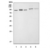 Western blot testing of 1) human HCCT, 2) rat brain, 3) mouse brain, 4) rat liver and 5) mouse liver tissue lysate with TMPRSS6 antibody. Predicted molecular weight ~90 kDa.