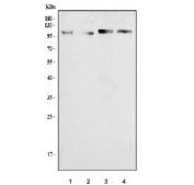 Western blot testing of human 1) MDA-MB-453, 2) PC-3, 3) Caco-2 and 4) HeLa cell lysate with TRPV3 antibody. Predicted molecular weight ~90 kDa.
