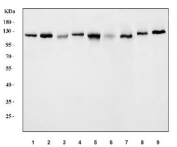 Western blot testing of 1) human HeLa, 2) human 293T, 3) human MCF7, 4) human A549, 5) human K562, 6) human SiHa, 7) rat brain, 8) mouse brain and 9) mouse NIH 3T3 cell lysate with USP10 antibody. Predicted molecular weight ~88 kDa but commonly observed at up to ~110 kDa.