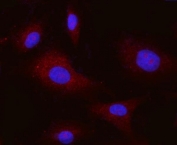 Immunofluorescent staining of FFPE human A549 cells with CD51 antibody (red) and DAPI nuclear stain (blue). HIER: steam section in pH6 citrate buffer for 20 min.