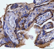 IHC staining of FFPE human placental tissue with CD51 antibody. HIER: boil tissue sections in pH8 EDTA for 20 min and allow to cool before testing.