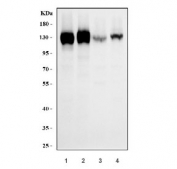Western blot testing of human 1) A549, 2) A431, 3) 293T and 4) MCF7 cell lysate with CD51 antibody. Expected molecular weight: 116-150 kDa.