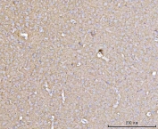 IHC staining of FFPE rat brain tissue with DBN1 antibody. HIER: boil tissue sections in pH8 EDTA for 20 min and allow to cool before testing.