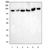 Western blot testing of 1) human HeLa, 2) human MOLT4, 3) human 293T, 4) monkey COS-7, 5) rat brain and 6) mouse brain tissue lysate with DBN1 antibody. Expected molecular weight: 70-120 kDa.
