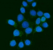 Immunofluorescent staining of FFPE human MCF7 cells with PMPCB antibody (green) and DAPI nuclear stain (blue). HIER: steam section in pH6 citrate buffer for 20 min.