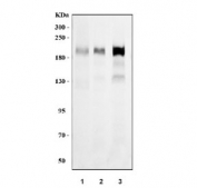 Western blot testing of human 1) A549, 2) PC-3 and 3) Caco-2 cell lysate with Integrin beta 4 antibody. Predicted molecular weight ~200 kDa.