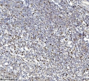 IHC staining of FFPE human chronic tonsillitis tissue with MCM7 antibody. HIER: boil tissue sections in pH8 EDTA for 20 min and allow to cool before testing.
