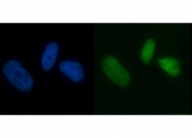 Immunofluorescent staining of FFPE human PC-3 cells with MCM7 antibody (green) and DAPI nuclear stain (blue). HIER: steam section in pH6 citrate buffer for 20 min.