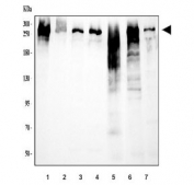 Western blot testing of 1) human Raji, 2) human SW620, 3) human COLO-320, 4) human 293T, 5) rat lung, 6) mouse lung and 7) mouse liver tissue lysate with TLN1 antibody. Predicted molecular weight ~275 kDa.