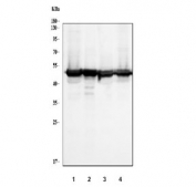 Western blot testing of human 1) 293T, 2) A431, 3) HepG2 and 4) Raji cell lysate with Regulator of Chromosome Condensation antibody. Predicted molecular weight ~45 kDa.