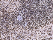IHC staining of FFPE human spleen tissue with RCC1 antibody. HIER: boil tissue sections in pH8 EDTA for 20 min and allow to cool before testing.