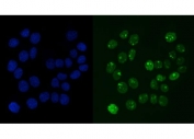 Immunofluorescent staining of FFPE human A431 cells with RCC1 antibody (green) and DAPI nuclear stain (blue). HIER: steam section in pH6 citrate buffer for 20 min.