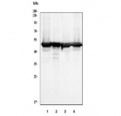 Western blot testing of human 1) 293T, 2) A431, 3) HepG2 and 4) Raji cell lysate with RCC1 antibody. Predicted molecular weight ~45 kDa.