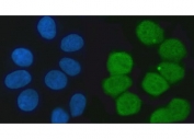 Immunofluorescent staining of FFPE human U-251 cells with KHSRP antibody (green) and DAPI nuclear stain (blue). HIER: steam section in pH6 citrate buffer for 20 min.