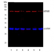 Western blot testing of 1) human Caco-2, 2) human K562, 3) human A549, 4) human 293T, 5) mouse NRK and 6) mouse NIH 3T3 cell lysate with KPNB1 antibody. Predicted molecular weight: ~97 kDa.