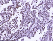 IHC staining of FFPE human ovary tissue with KPNB1 antibody. HIER: boil tissue sections in pH8 EDTA for 20 min and allow to cool before testing.