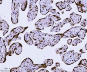 IHC staining of FFPE human placental tissue with KPNB1 antibody. HIER: boil tissue sections in pH8 EDTA for 20 min and allow to cool before testing.