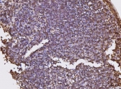 IHC staining of FFPE mouse lymph tissue with KPNB1 antibody. HIER: boil tissue sections in pH8 EDTA for 20 min and allow to cool before testing.