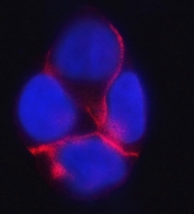 Immunofluorescent staining of FFPE human RT4 cells with Catenin delta 1 antibody (red) and DAPI nuclear stain (blue). HIER: steam section in pH6 citrate buffer for 20 min.