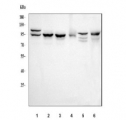 Western blot testing of 1) human A549, 2) human HaCaT, 3) human RT4, 4) human T-47D, 5) rat PC-12 and 6) rat C6 cell lysate with Catenin delta 1 antibody. Predicted molecular weight of ~108 kDa but commonly observed at 66-120 kDa (multiple isoforms).