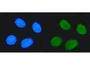 Immunofluorescent staining of FFPE human MCF7 cells with TRIM24 antibody (green) and DAPI nuclear stain (blue). HIER: steam section in pH6 citrate buffer for 20 min.