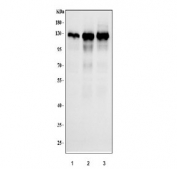 Western blot testing of human 1) HeLa, 2) MCF7 and 3) HepG2 cell lysate with TRIM24 antibody. Expected molecular weight: 117-140 kDa.