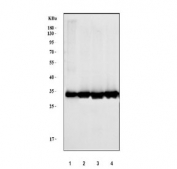 Western blot testing of human 1) A431, 2) Caco-2, 3) A549 and 4) HeLa cell lysate with ANXA3 antibody. Predicted molecular weight ~36 kDa.