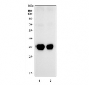 Western blot testing of human 1) Raji and 2) Daudi cell lysate with HLA-DRA antibody. Expected molecular weight ~35 kDa.