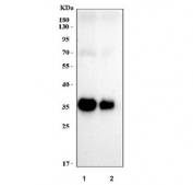 Western blot testing of human 1) Raji and 2) Daudi cell lysate with HLA-DRA antibody. Expected molecular weight ~35 kDa.