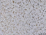IHC staining of FFPE mouse brain tissue with Ataxin 1 antibody. HIER: boil tissue sections in pH8 EDTA for 20 min and allow to cool before testing.