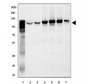 Western blot testing of 1) human HCCP, 2) human 293T, 3) human A549, 4) rat liver, 5) rat kidney, 6) mouse liver and 7) mouse kidney tissue lysate with GLDC antibody. Predicted molecular weight ~113 kDa.