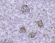 IHC staining of FFPE mouse kidney tissue with Integrin linked ILK antibody. HIER: boil tissue sections in pH8 EDTA for 20 min and allow to cool before testing.