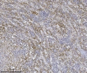 IHC staining of FFPE human spleen tissue with Integrin linked ILK antibody. HIER: boil tissue sections in pH8 EDTA for 20 min and allow to cool before testing.