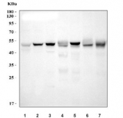 Western blot testing of 1) human MCF7, 2) human HeLa, 3) human U-87 MG, 4) rat heart, 5) rat kidney, 6) mouse heart and 7) mouse kidney tissue lysate with Integrin linked ILK antibody. Expected molecular weight: 51-59 kDa.