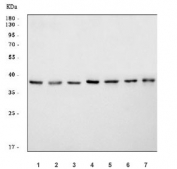 Western blot testing of 1) human SiHa, 2) human HaCaT, 3) human A549, 4) rat brain, 5) rat lung, 6) mouse brain and 7) mouse lung tissue lysate with Alpha/beta-hydrolase 4 antibody. Predicted molecular weight ~39 kDa.