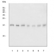 Western blot testing of 1) human PC-3, 2) human HeLa, 3) human HepG2, 4) rat C6, 5) rat PC-12, 6) mouse 4T1 and 7) mouse C2C12 cell lysate with ACP1 antibody. Predicted molecular weight 12-18 kDa (isoforms 1-4).