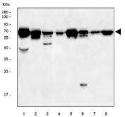 Western blot testing of 1) rat heart, 2) rat skeletal muscle, 3) rat thymus, 4) rat C6, 5) mouse heart, 6) mouse skeletal muscle, 7) mouse thymus and 8) mouse C2C12 cell lysate with Adam17 antibody. Expected molecular weight: 74-130 kDa depending on level of glycosylation