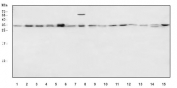 Western blot testing of 1) human placenta, 2) human PC-3, 3) human HeLa, 4) human HepG2, 5) human 293T, 6) human A431, 7) human A549, 8) rat brain, 9) rat liver, 10) rat PC-12, 11) rat NRK, 12) mouse brain, 13) mouse liver, 14) mouse Neuro-2a and 15) mouse RAW264.7 cell lysate with ALYREF antibody. Predicted molecular weight ~27 kDa.