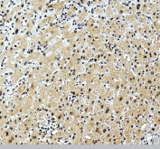 IHC staining of FFPE human liver tissue with ALYREF antibody, HRP-secondary and DAB substrate. HIER: boil tissue sections in pH8 EDTA for 20 min and allow to cool before testing.