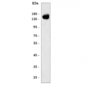Western blot testing of human 293T cell lysate with Angiomotin antibody. Predicted molecular weight: 118-130 kDa (p130 isoform) and 72-80 kDa (p80 isoform).