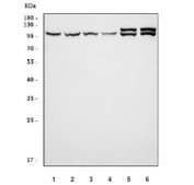 Western blot testing of 1) human HeLa, 2) human MCF7, 3) human RT4, 4) human U-251, 5) rat brain and 6) mouse brain tissue lysate with ARHGAP26 antibody. Predicted molecular weight ~92 kDa (isoform 1) and ~86 kDa (isoform 2).