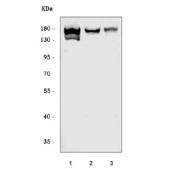 Western blot testing of human 1) HeLa, 2) Raji and 3) A549 cell lysate with ARHGAP45 antibody. Predicted molecular weight ~125 kDa but can be observed at higher molecular weights.