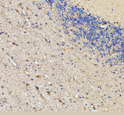 IHC staining of FFPE human stomach tissue with ATP4A antibody, HRP-secondary and DAB substrate. HIER: boil tissue sections in pH8 EDTA for 20 min and allow to cool before testing.