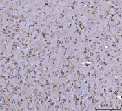 IHC staining of FFPE mouse brain tissue with BBS9 antibody. HIER: boil tissue sections in pH8 EDTA for 20 min and allow to cool before testing.
