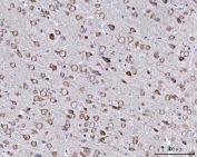 IHC staining of FFPE rat brain tissue with BBS9 antibody. HIER: boil tissue sections in pH8 EDTA for 20 min and allow to cool before testing.