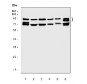 Western blot testing of 1) human U-87 MG, 2) human SiHa, 3) human HeLa, 4) human SH-SY5Y, 5) monkey COS-7 and 6) human 293T cell lysate with BBS9 antibody. Expected molecular weight: 94-99 kDa (multiple isoforms).