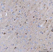 IHC staining of FFPE mouse brain tissue with BCAT1 antibody. HIER: boil tissue sections in pH8 EDTA for 20 min and allow to cool before testing.