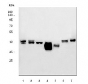 Western blot testing of 1) human Raji, 2) human MOLT4, 3) human HeLa, 4) rat pancreas, 5) rat kidney, 6) mouse kidney and 7) mouse Neuro-2a cell lysate with BCAT1 antibody. Predicted molecular weight ~43 kDa.