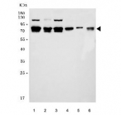 Western blot testing of 1) human SiHa, 2) human MOLT-4, 3) human HeLa, 4) rat brain, 5) mouse brain and 6) mouse lung tissue lysate with Bromodomain-containing protein 9 antibody. Predicted molecular weight ~67 kDa, commonly observed at 67-85 kDa.