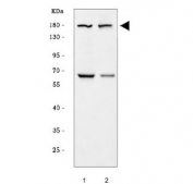Western blot testing of 1) rat testis and 2) mouse testis tissue with BRDT antibody. Predicted molecular weight ~108 kDa.